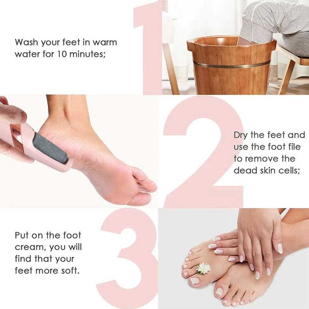 Rechargeable Electric Callus Remover – Cordless Foot File