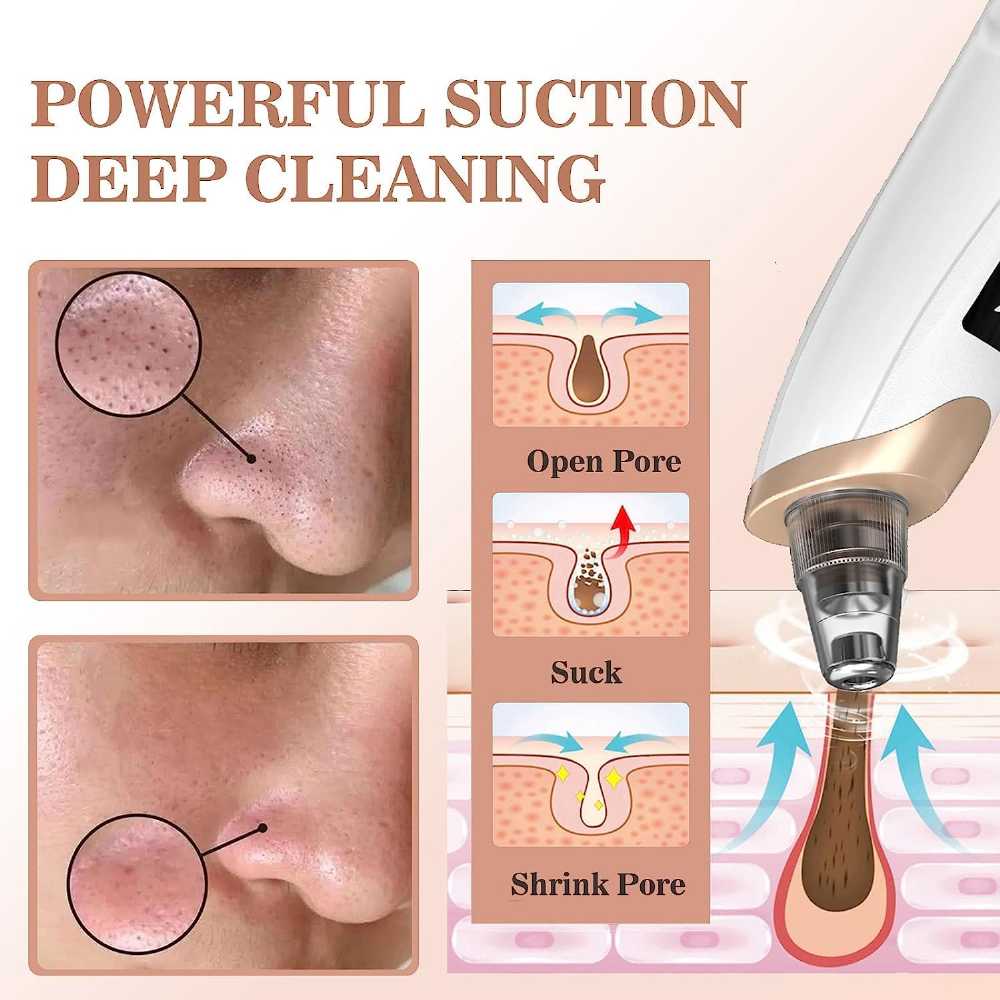 5-in-1 Electric Blackhead Remover Pore Vacuum